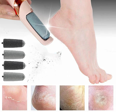 Lixa Elétrica Para os Pés Recarregável USB